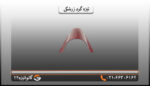 ابعاد تیزه پرچین گرد