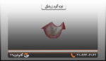 تیزه پرچین