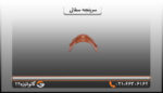 سرپنجه سفالی